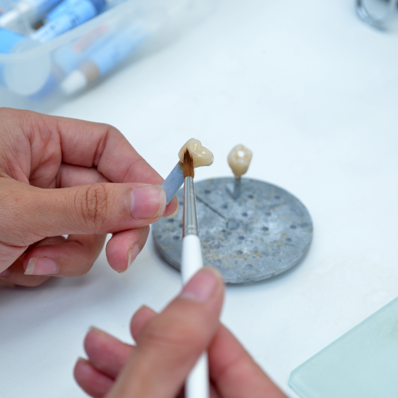 Dentistes_Noumea_Motorpool_Conception_assistée_par_ordinateur_Prothese_Dentaire