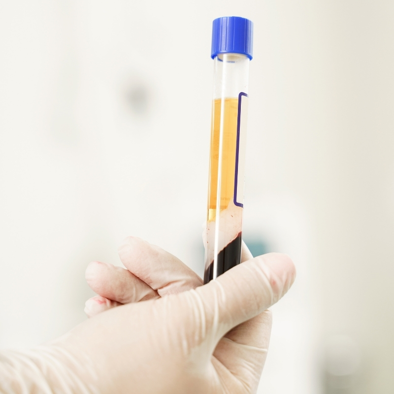 Dentistes_Noumea_Motorpool_PRF