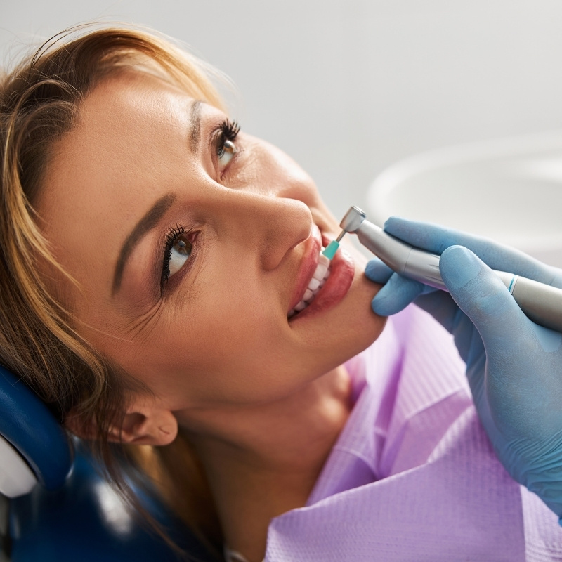 Esthetique_Dentaire_Polissage_Cosmetique