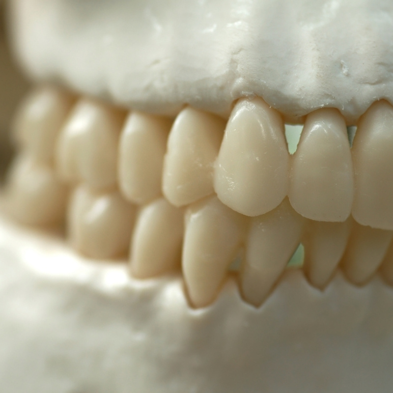 Chirurgie_Dentaire_Cabinet_Motorpool_Dentistes_Noumea_Comblement_Osseux_Alveolaire