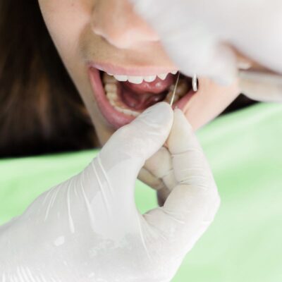 Devitalisation_Dentaire_Cabinet_Motorpool_Noumea_Dentiste