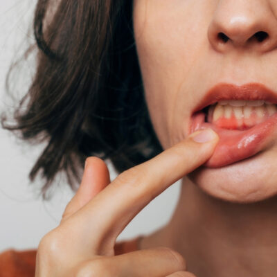 Saignement_des_gencives_Cabinet_Motorpool_Noumea