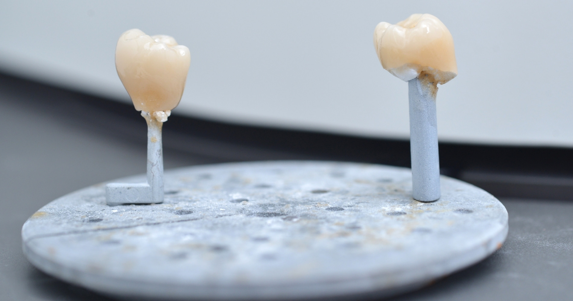 Protheses_Dentaires_Noumea_Cabinet_Motorpool_Dentiste_Cerec